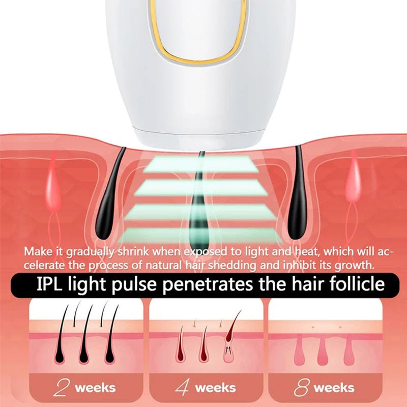 Epilateur laser - Maison Princesse